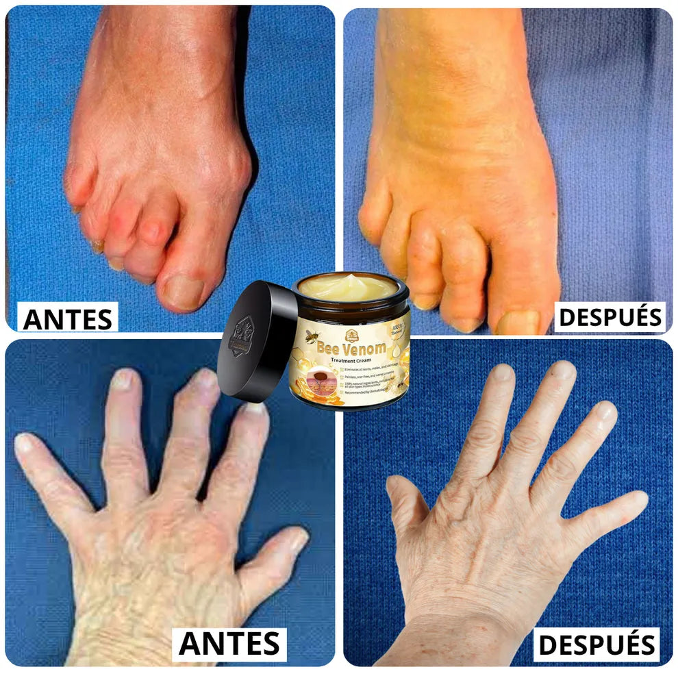 [PAGA 1, LLEVA 2] BeeVenom™ - Crema Reparadora con Veneno de Abeja y Extractos Naturales