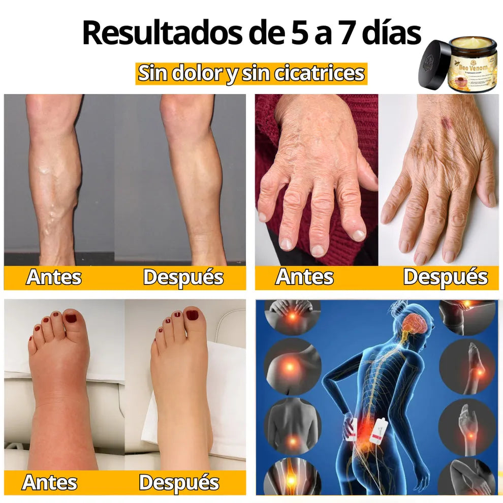 [PAGA 1, LLEVA 2] BeeVenom™ - Crema Reparadora con Veneno de Abeja y Extractos Naturales