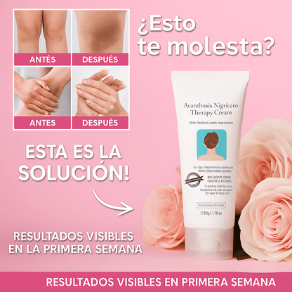 🌸 BellaLuz 🌸 Crema Blanqueadora Hipoalergénica – Despídete de las manchas oscuras de tu piel antes de Navidad.