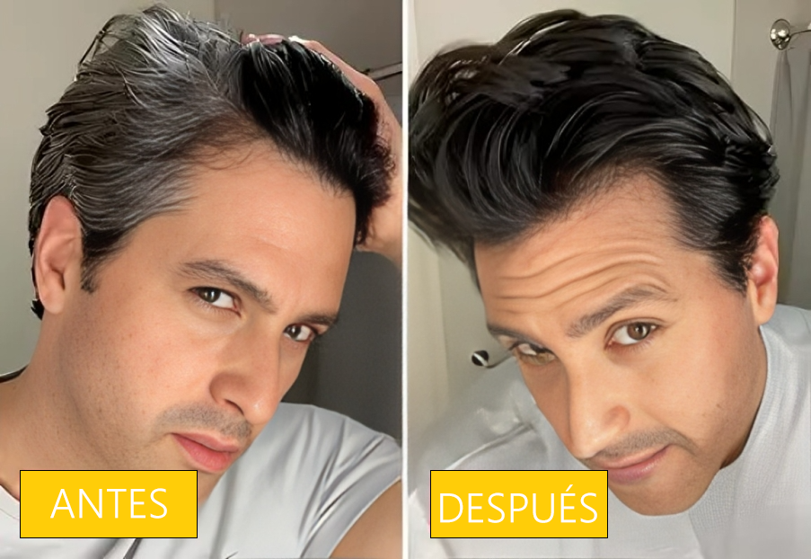 [Compra 1 y Lleva 1 Gratis] Jabón Tratamiento AntiCanas y Crecimiento Del Cabello 2x1 - OnixSoap™