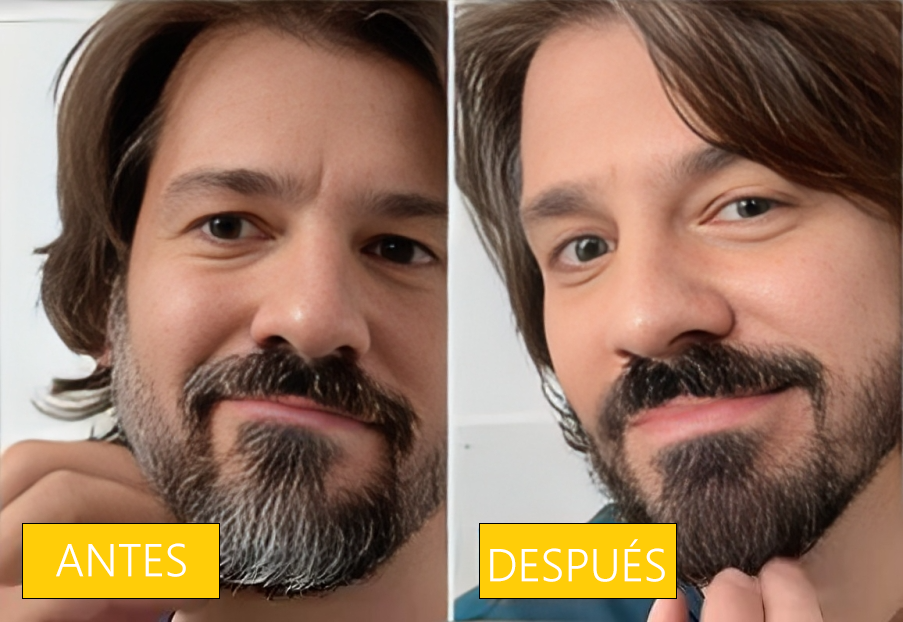 [Compra 1 y Lleva 1 Gratis] Jabón Tratamiento AntiCanas y Crecimiento Del Cabello 2x1 - OnixSoap™