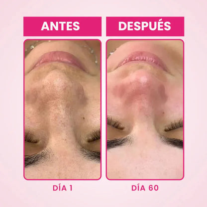 🌸 BellaLuz 🌸 Crema Blanqueadora Hipoalergénica – Despídete de las manchas oscuras de tu piel antes de Navidad.
