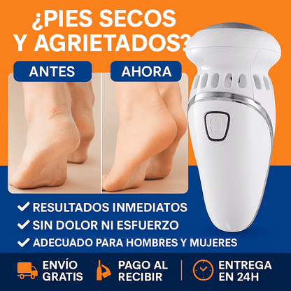 Removedor de Callos Eléctrico con Rodillo Exfoliante y Cabezal Reemplazable